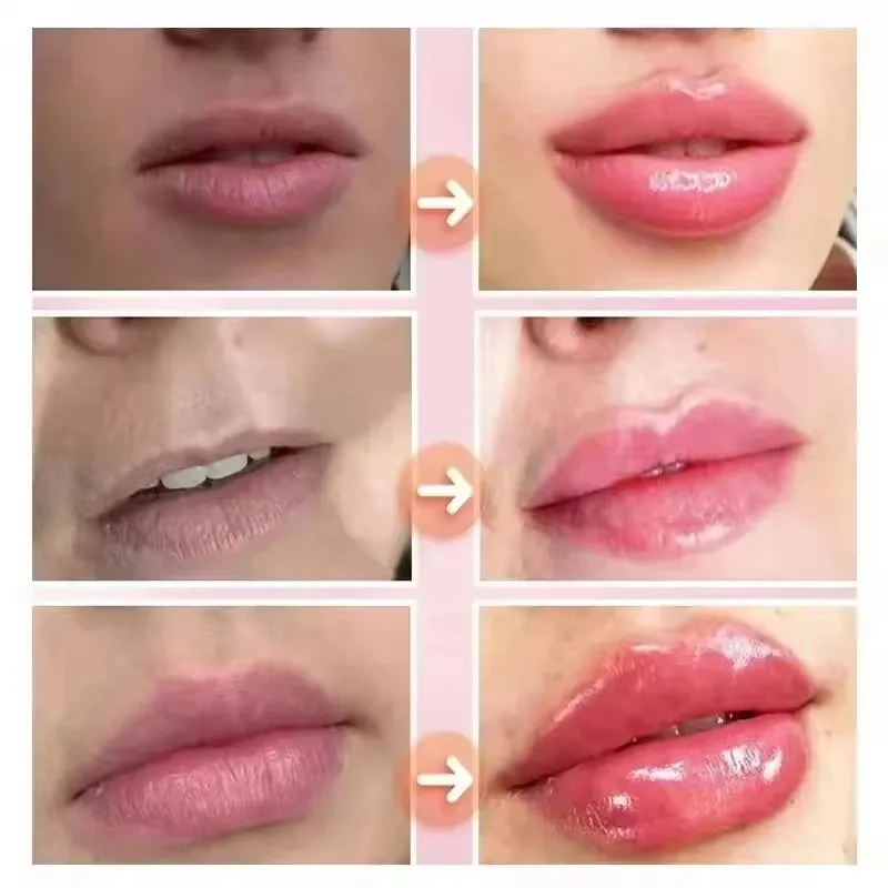 즉각적인 입술 볼륨업 에센셜 오일 영양 주름 방지 보습 - Lip Gloss Plumping 리뷰 및 가격