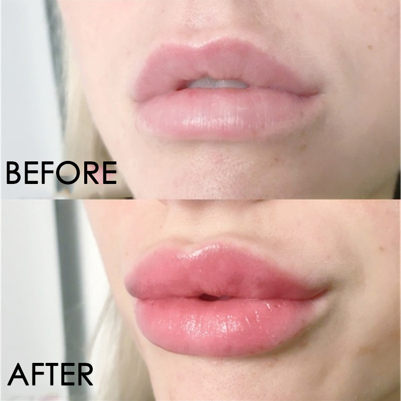 립 케어 세럼, 인스턴트 볼류미싱 립 플럼 퍼, 모이스 - Lip Gloss Plumping 리뷰 및 가격